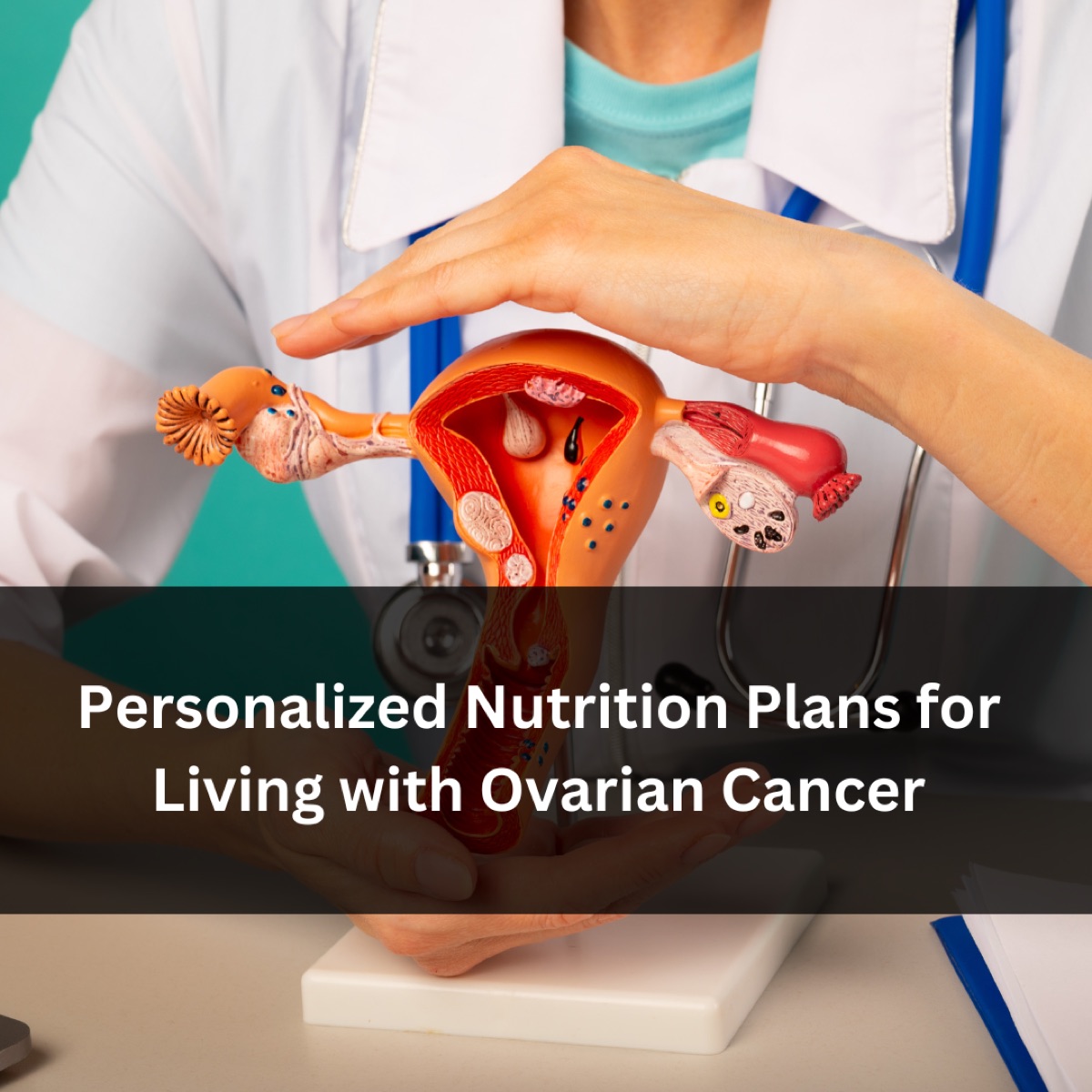 Personalized Nutrition Plans for Living with Ovarian Cancer