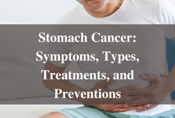 Stomach Cancer: Symptoms, Types, Treatments, and Preventions