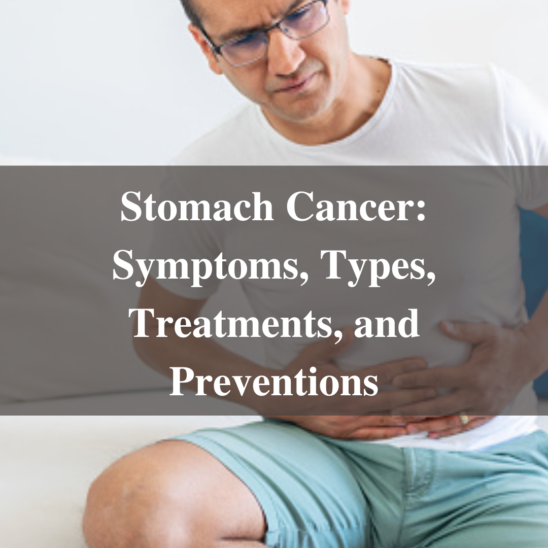 Stomach Cancer: Symptoms, Types, Treatments, and Preventions