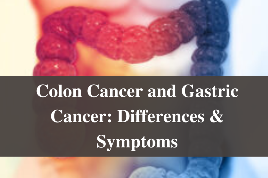 Colon Cancer and Gastric Cancer: Differences & Symptoms