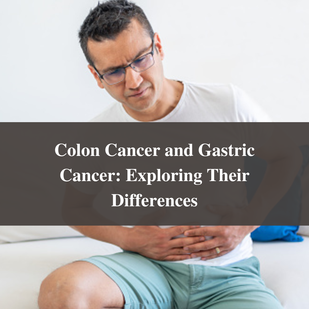 Colon Cancer and Gastric Cancer: Exploring Their Differences