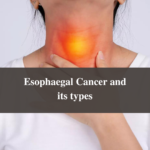 Esophaegal Cancer and its types
