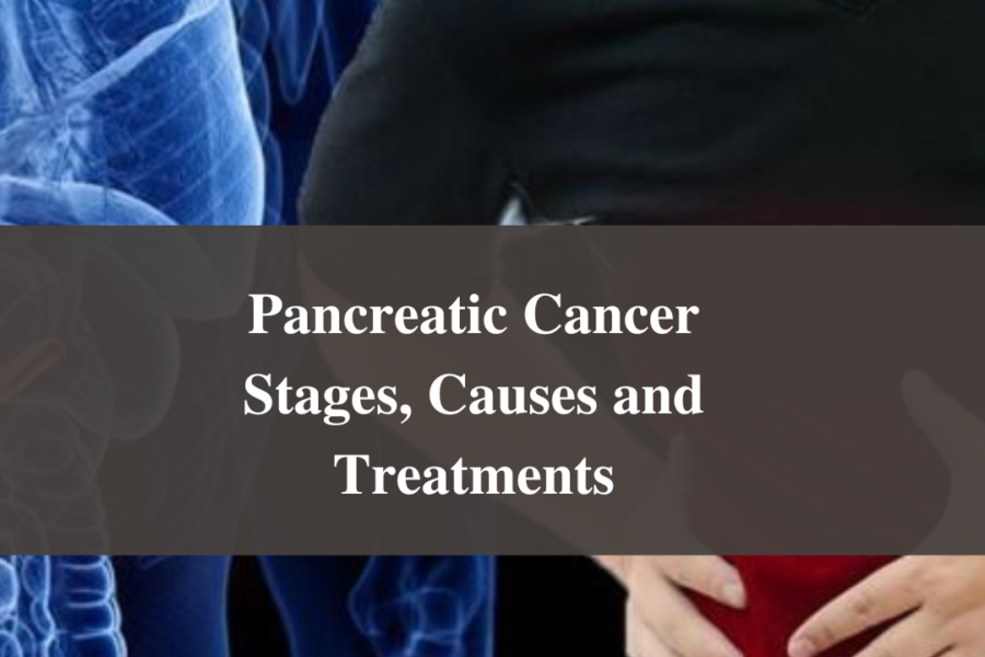 Pancreatic Cancer Stages, Causes and Treatments