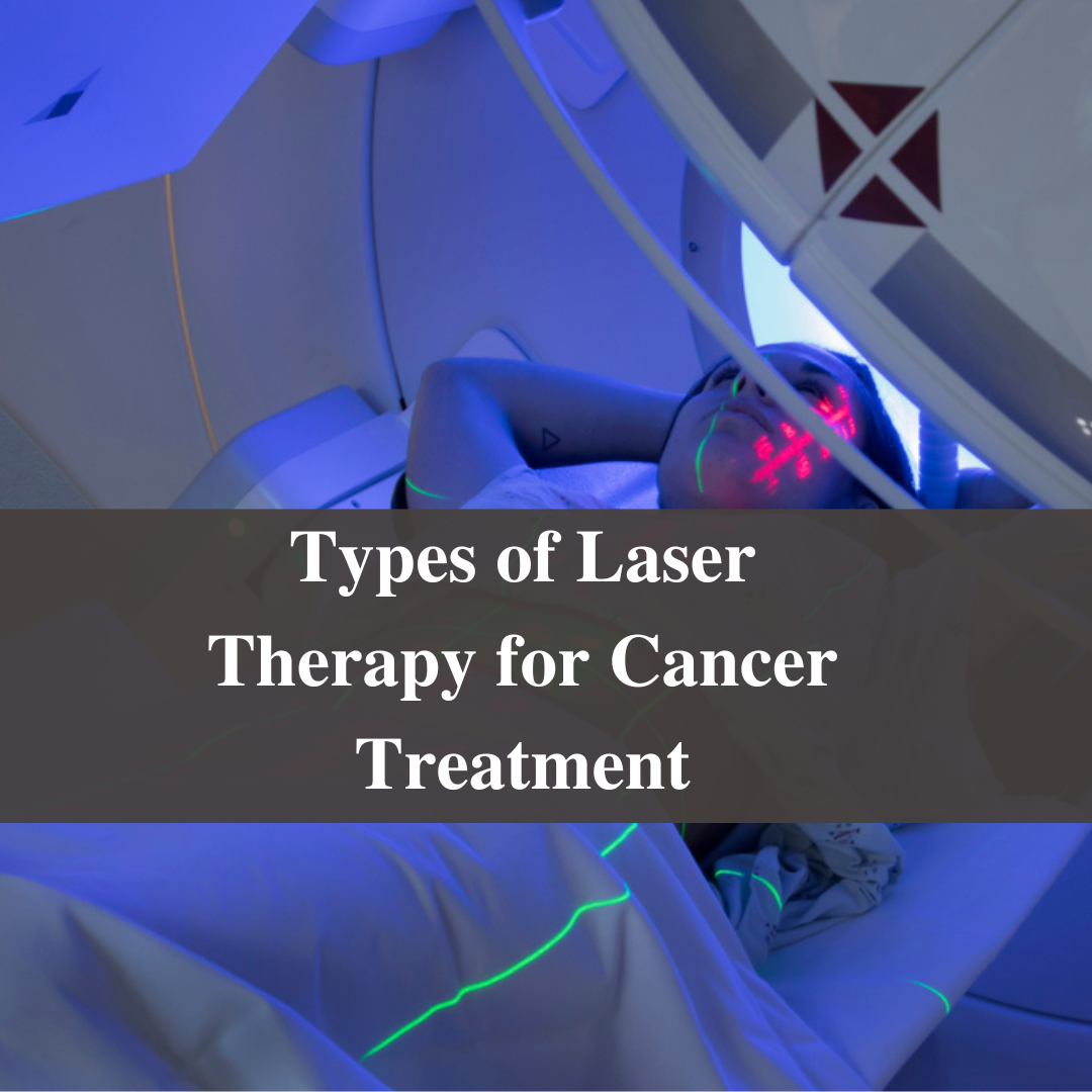 Types of Laser Therapy for Cancer Treatment