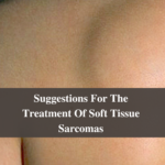 Suggestions For The Treatment Of Soft Tissue Sarcomas