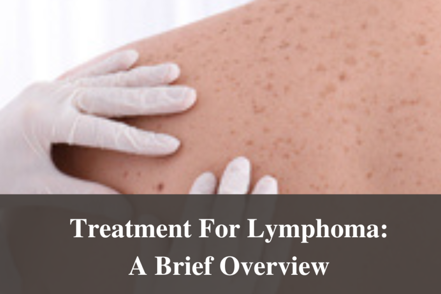 Treatment For Lymphoma: A Brief Overview