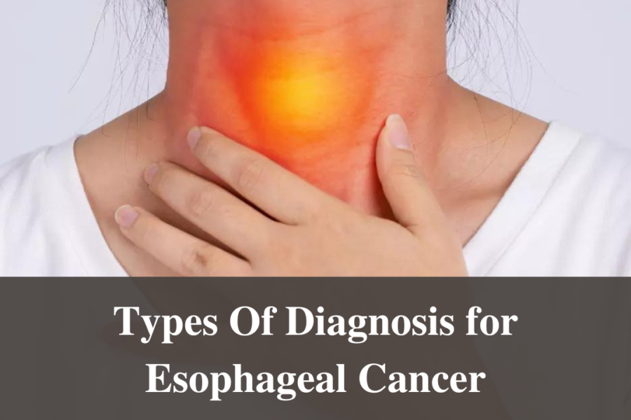 Types Of Diagnosis for Esophageal Cancer