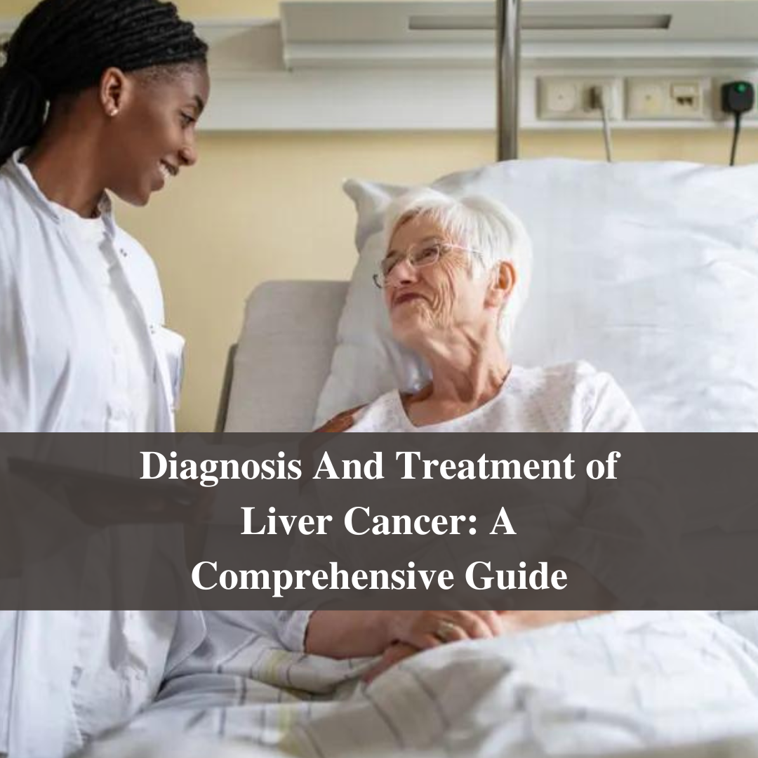 Diagnosis And Treatment of Liver Cancer: A Comprehensive Guide