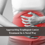 Approaching Esophageal Cancer Treatment In A Novel Way