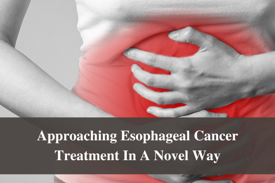 Approaching Esophageal Cancer Treatment In A Novel Way
