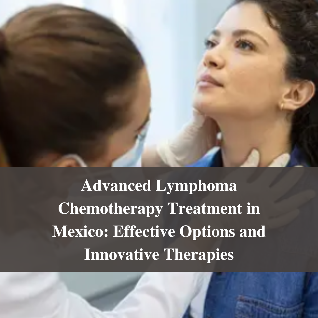 Advanced Lymphoma Chemotherapy Treatment in Mexico: Effective Options and Innovative Therapies