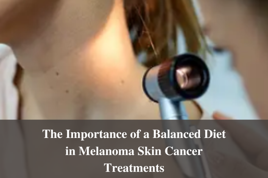 The Importance of a Balanced Diet in Melanoma Skin Cancer Treatments