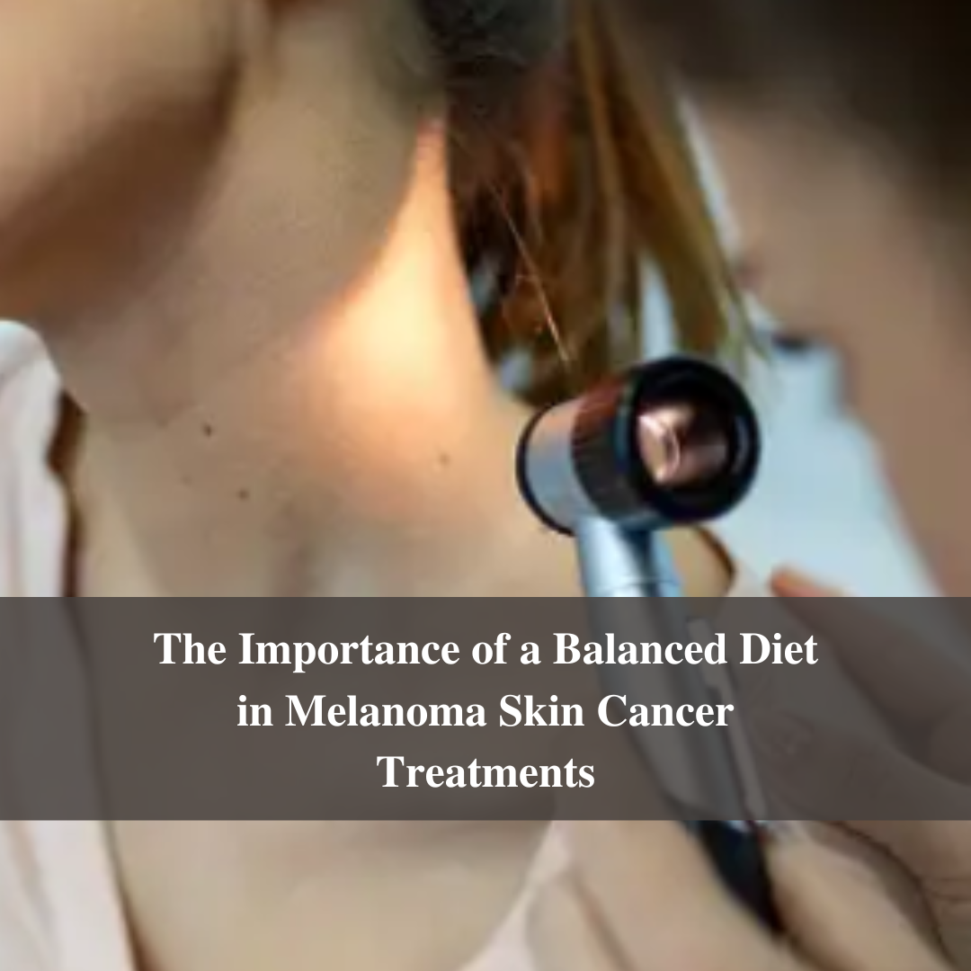 The Importance of a Balanced Diet in Melanoma Skin Cancer Treatments