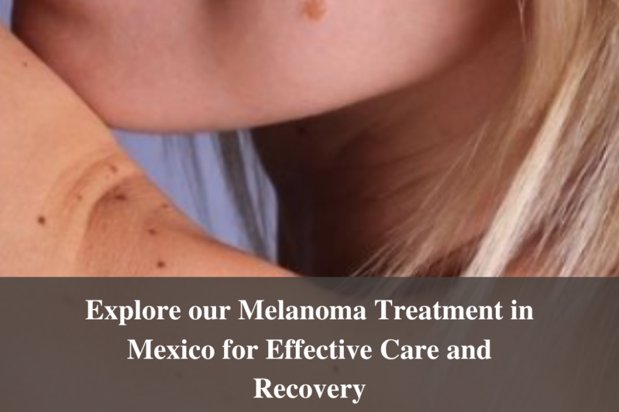 Explore our Melanoma Treatment in Mexico for Effective Care and Recovery