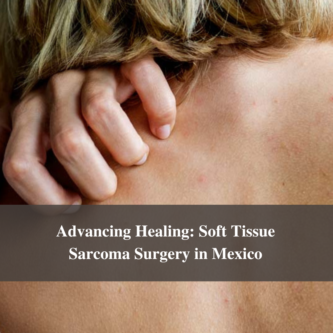 Advancing Healing: Soft Tissue Sarcoma Surgery in Mexico