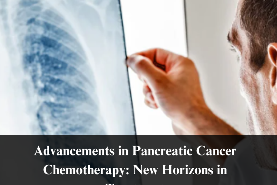 Advancements in Pancreatic Cancer Chemotherapy: New Horizons in Treatment