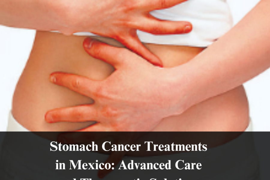 Stomach Cancer Treatments in Mexico: Advanced Care and Therapeutic Solutions