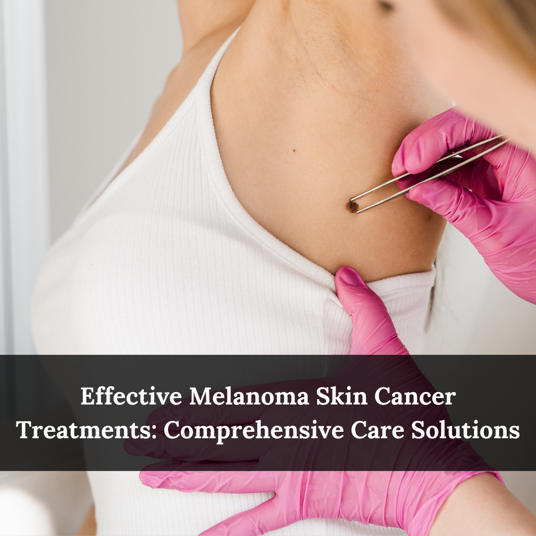 Melanoma Skin Cancer Treatments
